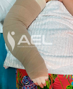 Prenda de compresión